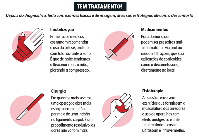 síndrome do túnel do carpo