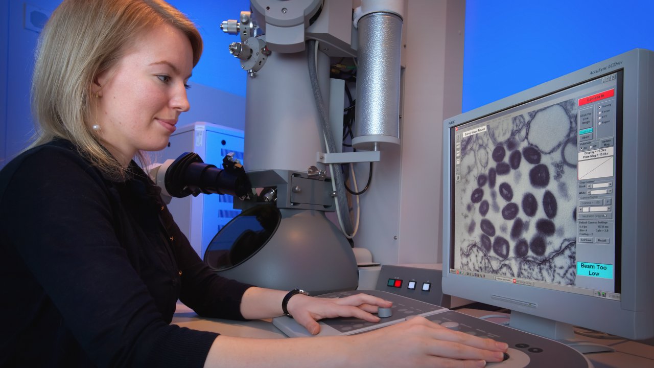 Foto de cientistas olhando o vírus da varíola dos macacos no microscópio