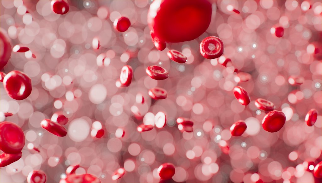 o que é anemia falciforme