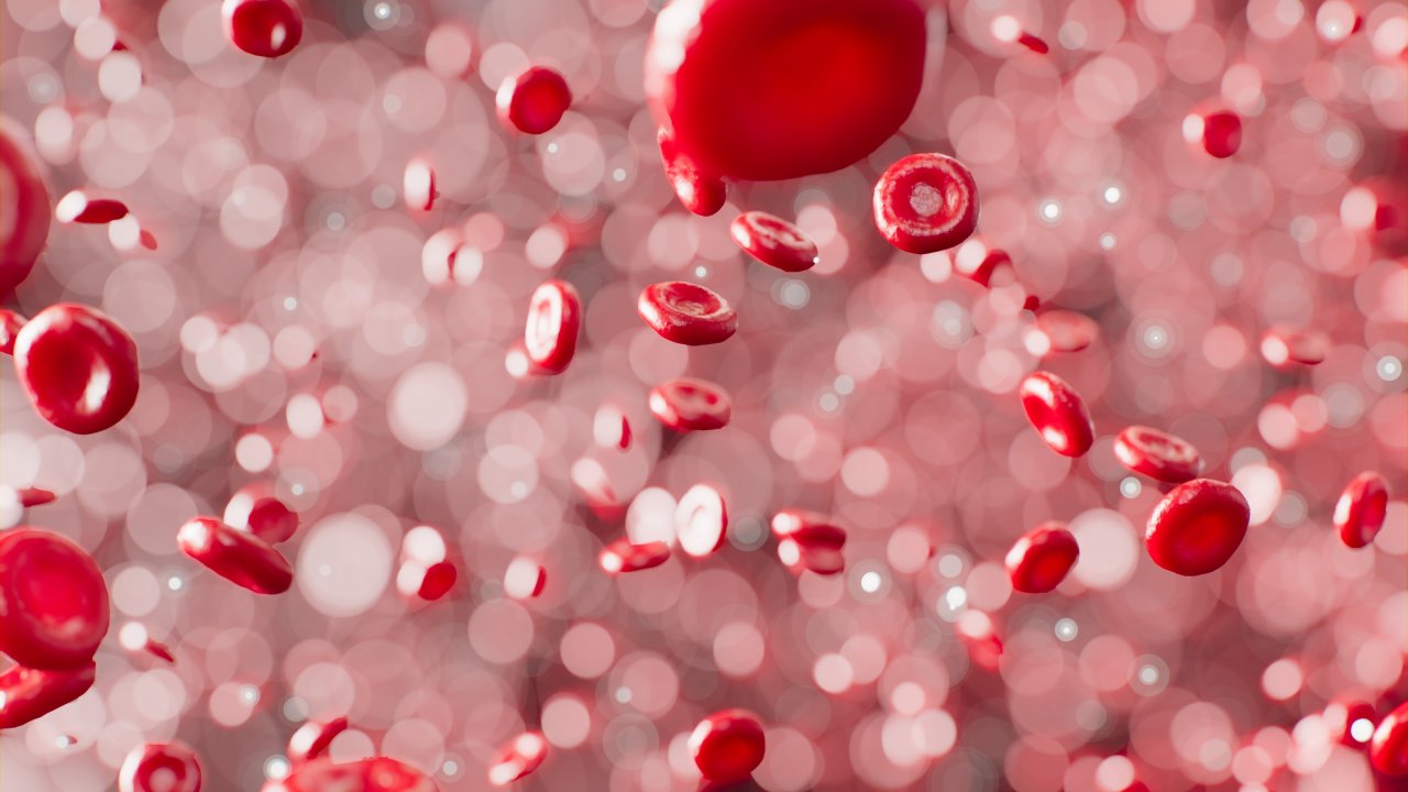 o que é anemia falciforme