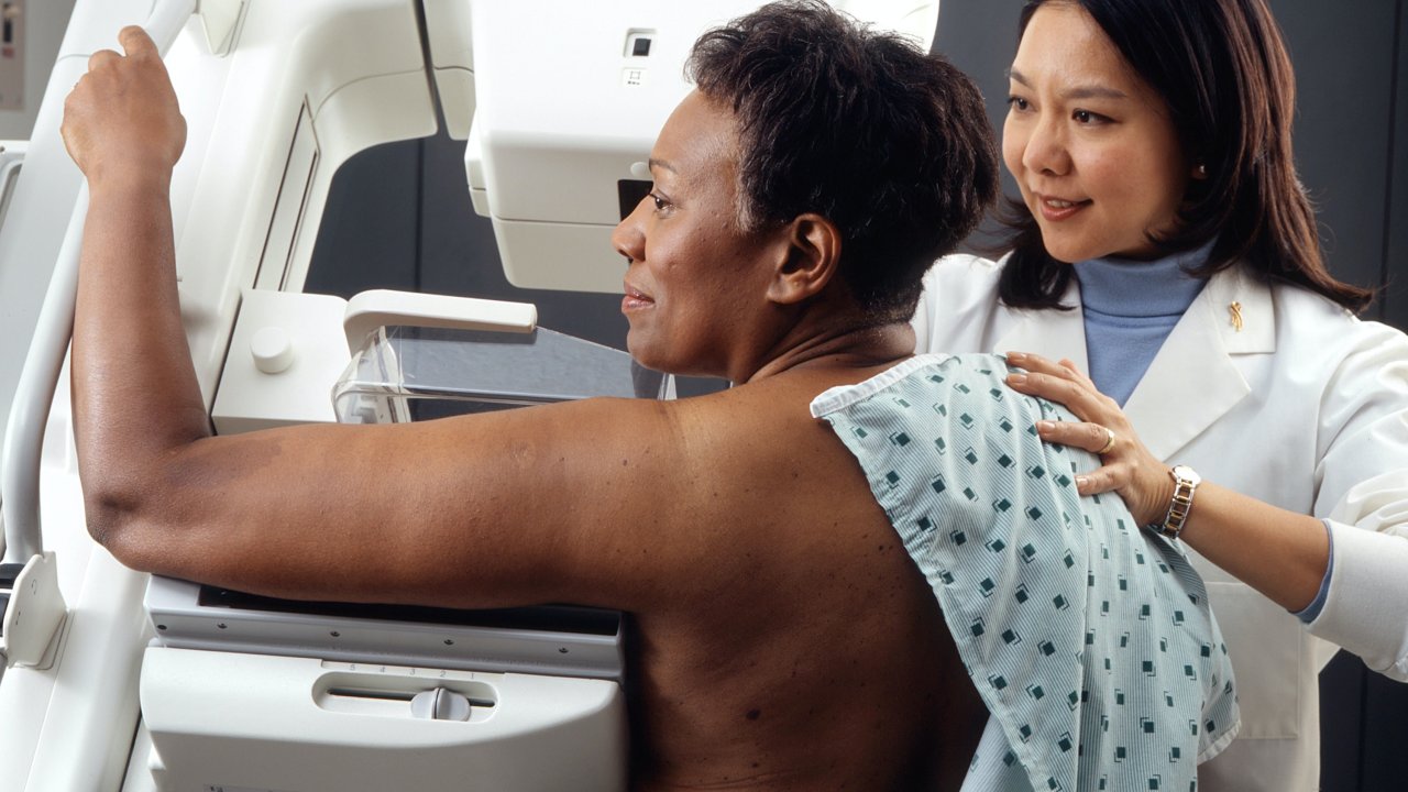 Foto de mulher negra fazendo mamografia
