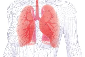 Câncer de pulmão segue liderando estatísticas, apesar de novos recursos