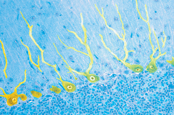 Foto tirada via microscópio expõe neurônios humanos.