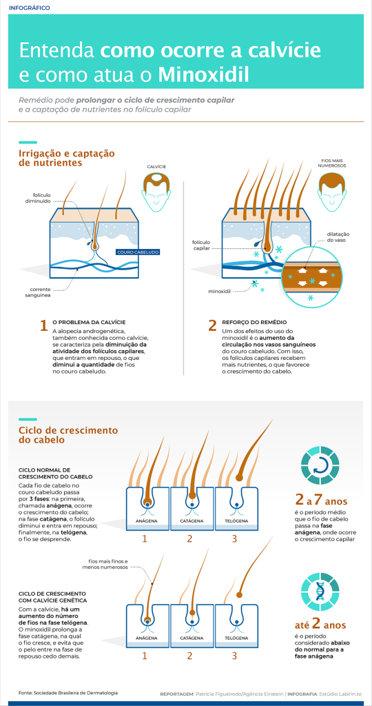 Informações sobre calvicie