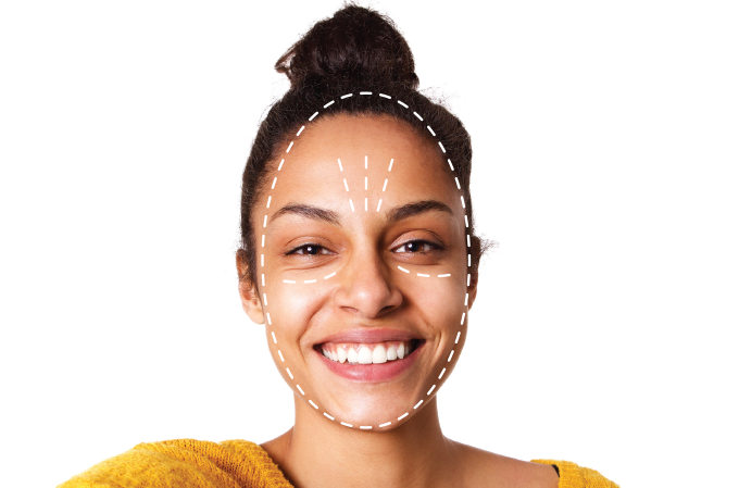 foto de mulher com listras de procedimento no rosto