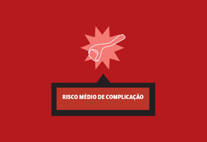 materia-procedimentos-esteticos-selo-microagulhamento materia-procedimentos-esteticos-selo-microagulhamento