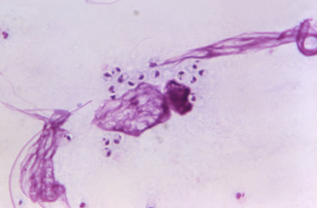 leishmania-parasito-protozoario-leishmaniose