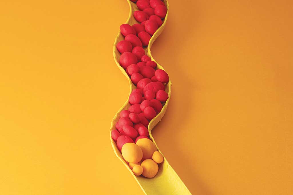 O que explica tantos jovens com colesterol alto no Brasil?