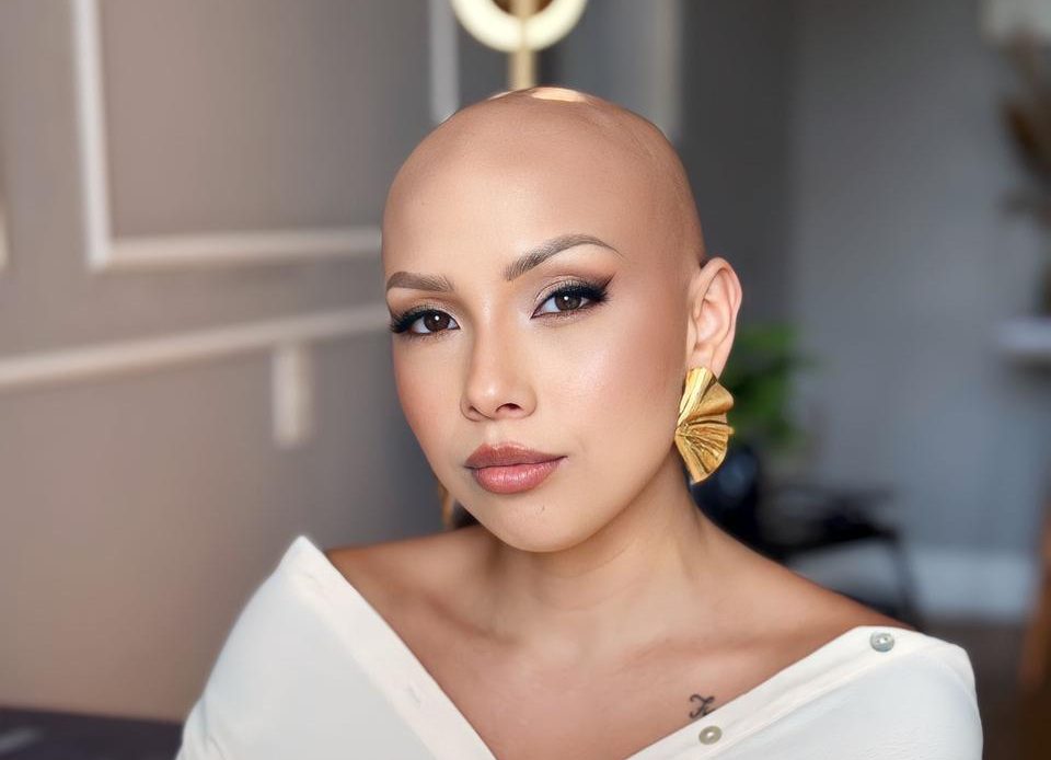 em-primeira-pessoa-alopecia-fernanda-ayub-01