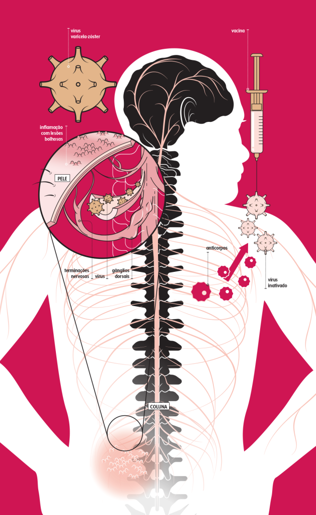 497-sqs-vacina-herpes-zoster-info