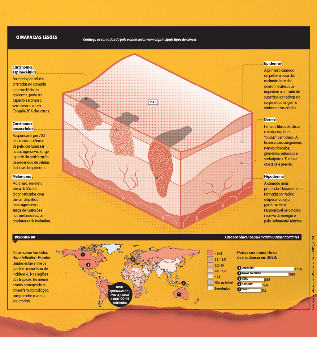 câncer-pele-tipos