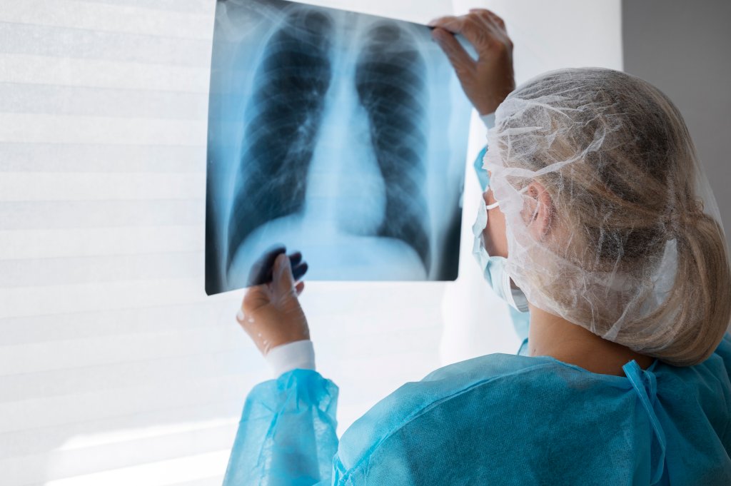 saude-pulmonar-pulmoes-radiografia-raio-x