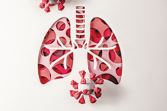 pneumonite-pneumonia-causas