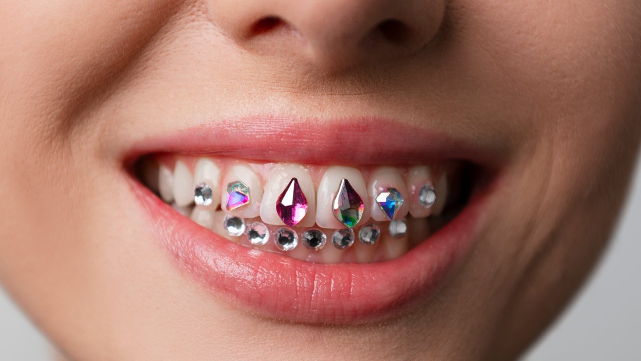 saude-bucal-odontologia-implantes-joia-dental