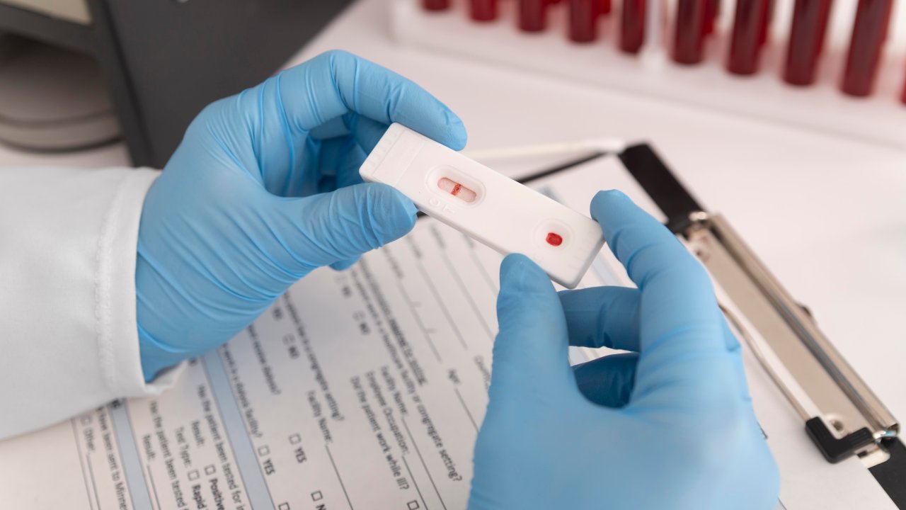teste-rapido-dengue-quais-os-tipos-quando-fazer-antigeno-anticorpos-sorologico