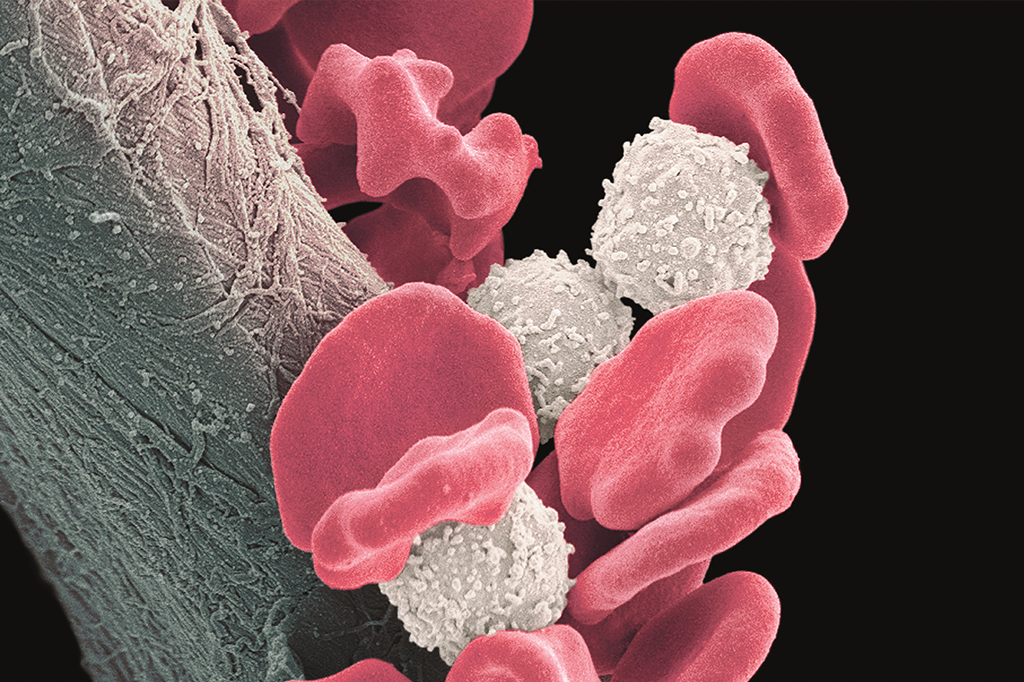 Zoom: uma estranha no ninho