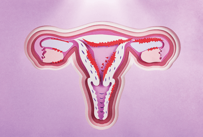 mes-da-endometriose