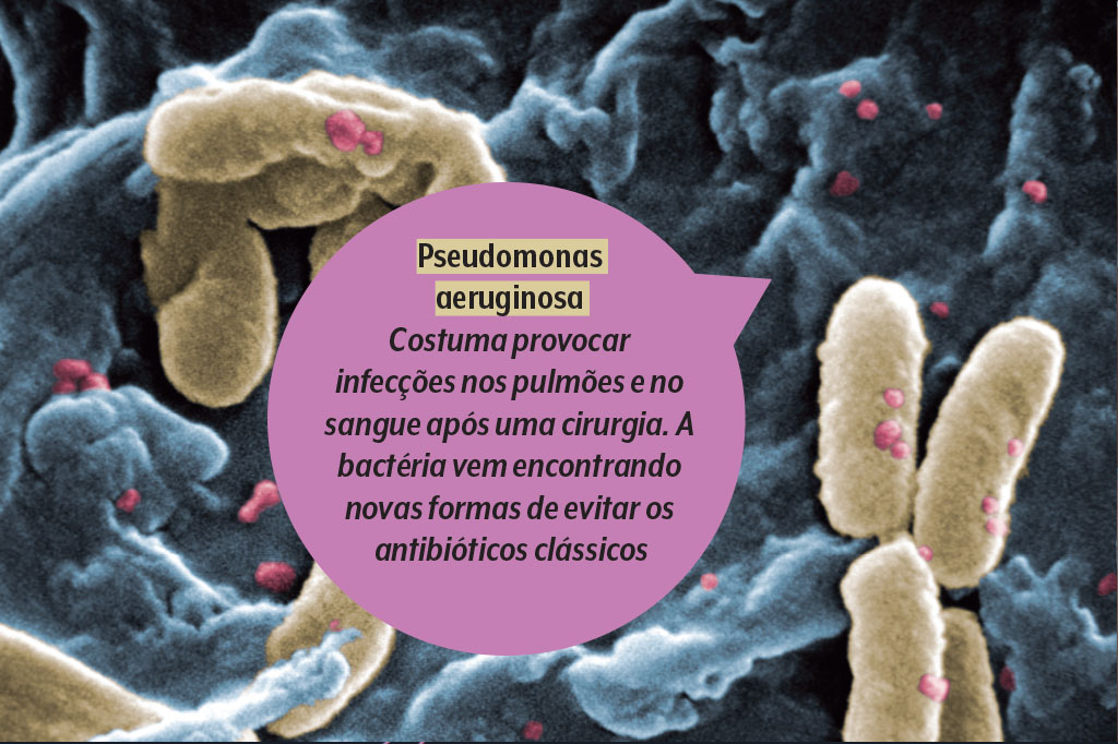 saude-supermicrobios-resistencia-antimicrobiana-bacteria-pseudomonas-aeruginosa