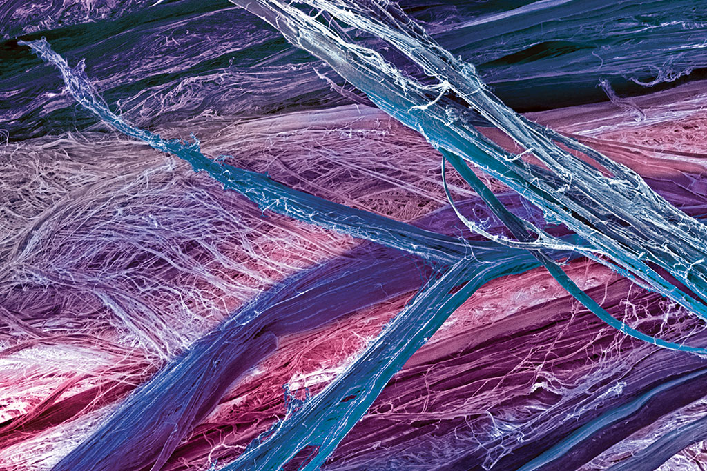 Zoom: muito bem amarrado