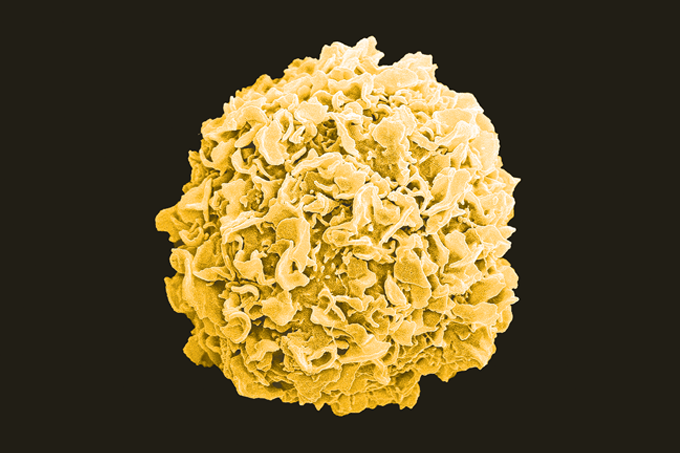 O Dia Mundial de Combate ao Câncer deveria valer o ano todo!