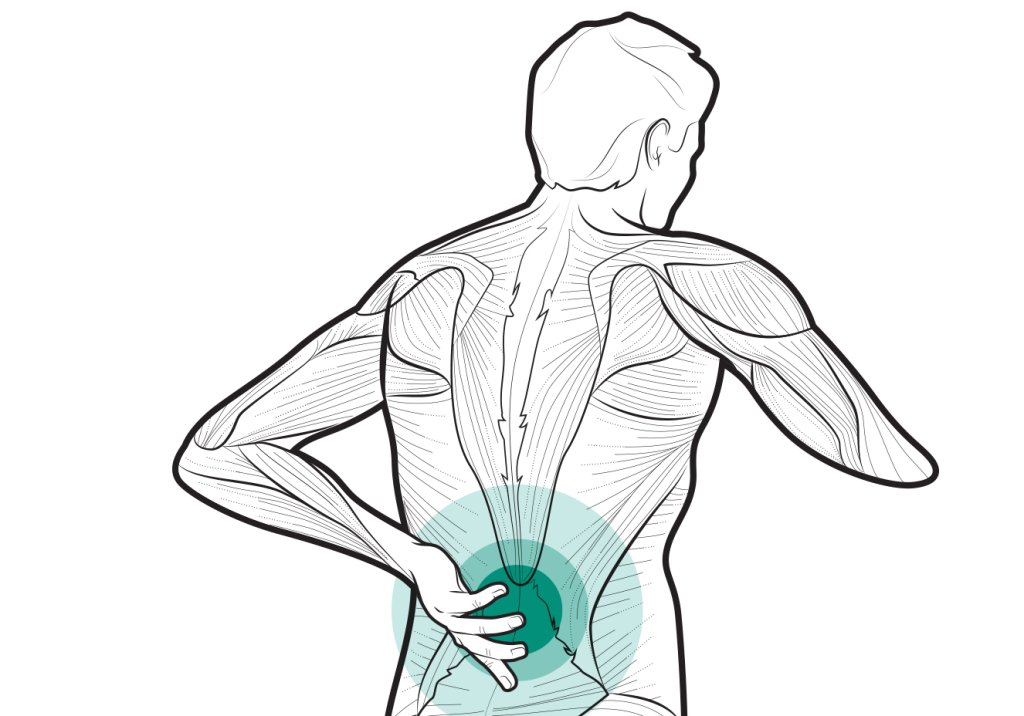 Estilo de vida saudável reduz significativamente a dor nas costas
