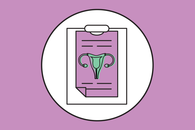 Há cura para endometriose profunda? Tratamentos, sintomas e perspectivas