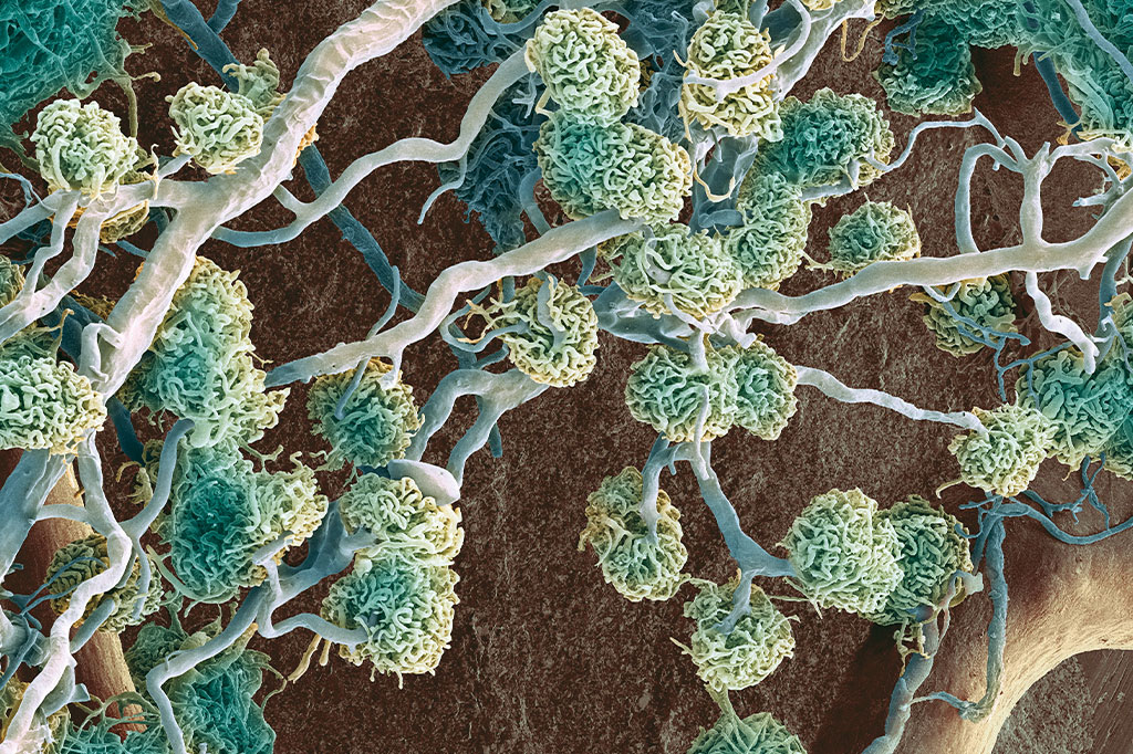 Zoom: saneamento básico do corpo