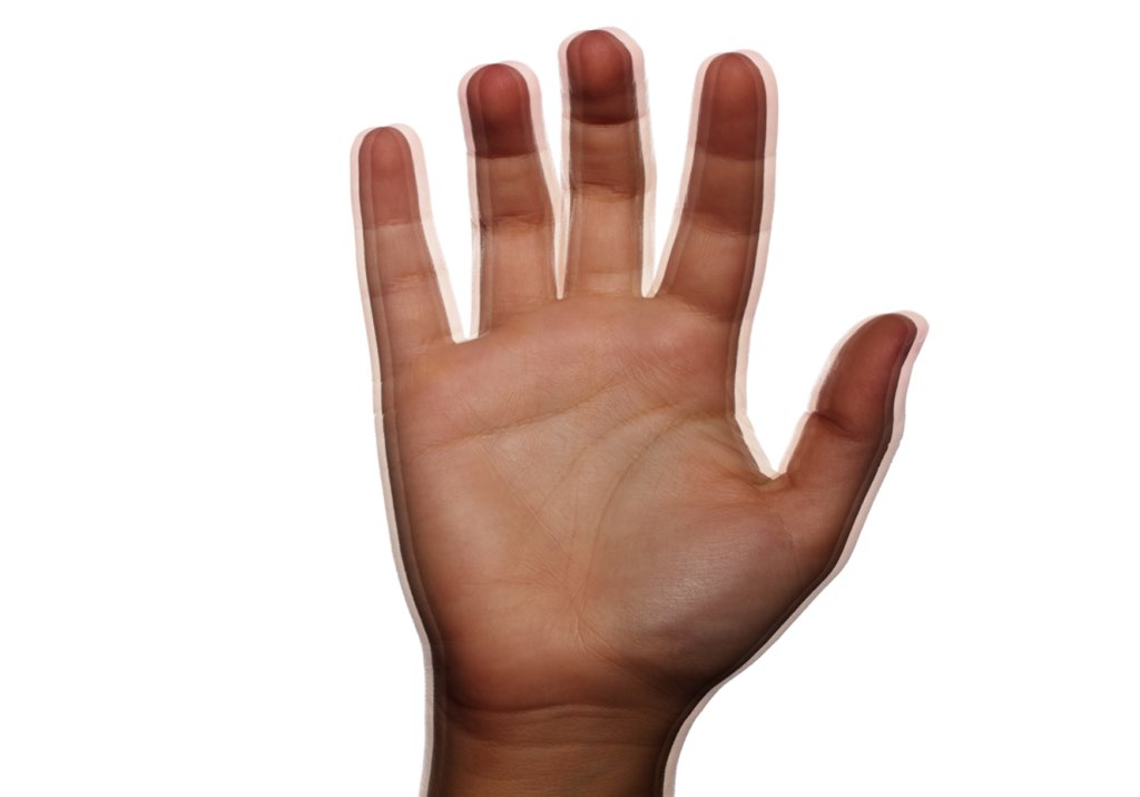 Parkinson: nova tecnologia controla 70% dos tremores de forma imediata