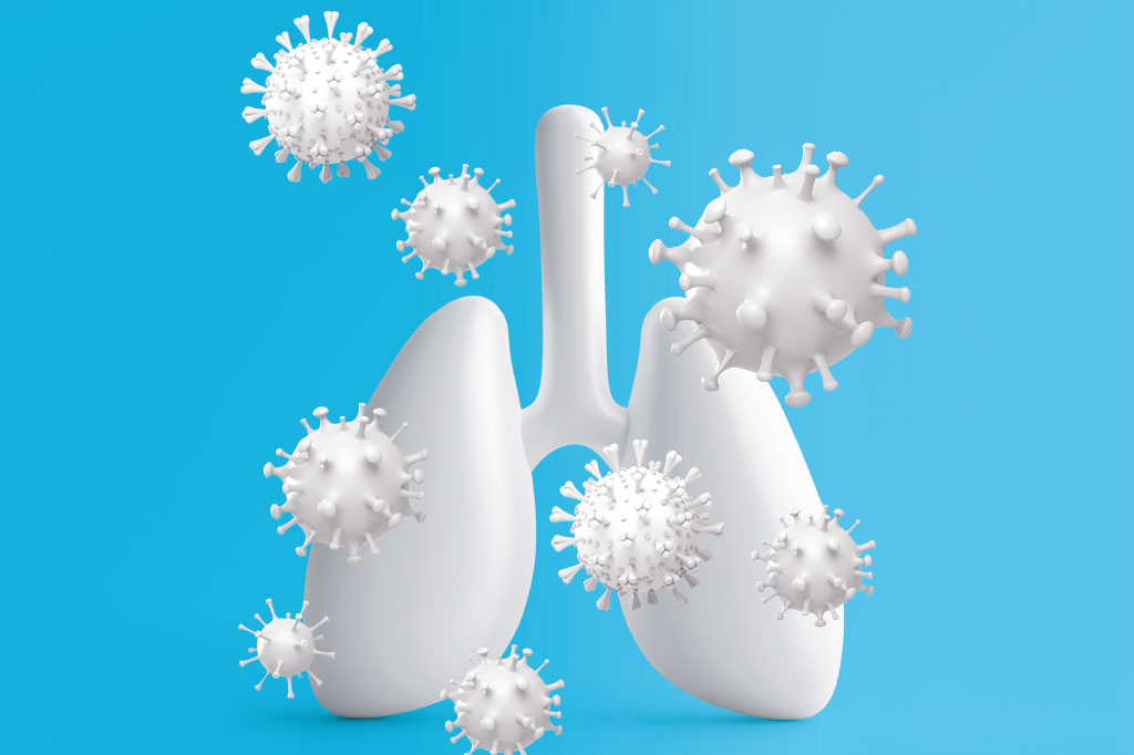 saude-virus-respiratorios-gripe-influenza-covid-coronavirus-virus-sincicial-rinovirus
