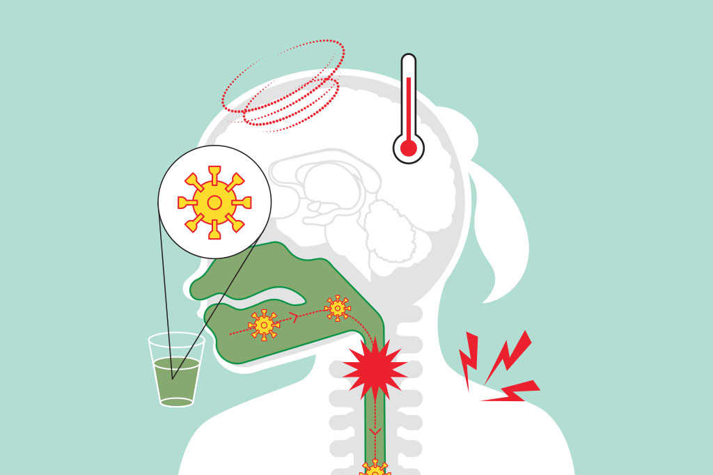 Por que crianças têm de ser vacinadas contra o rotavírus?