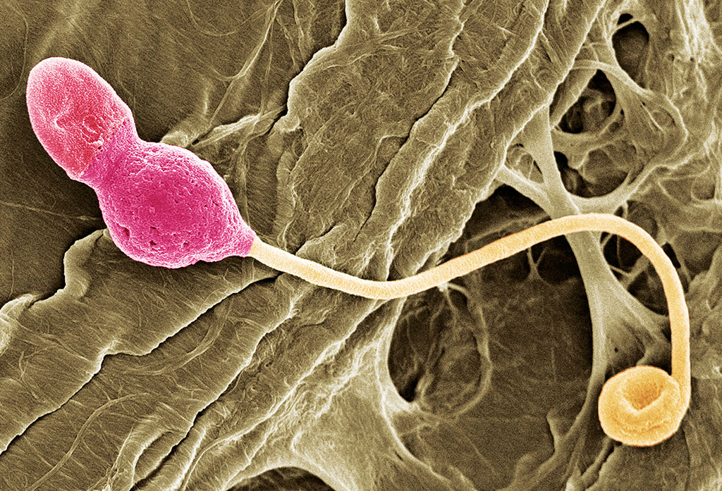 Exposição a poluentes reduz qualidade do sêmen em homens