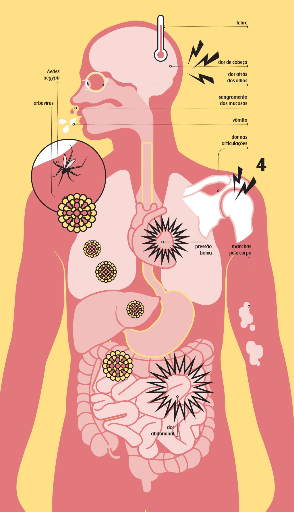 Como Funciona A Nova Vacina Da Dengue?