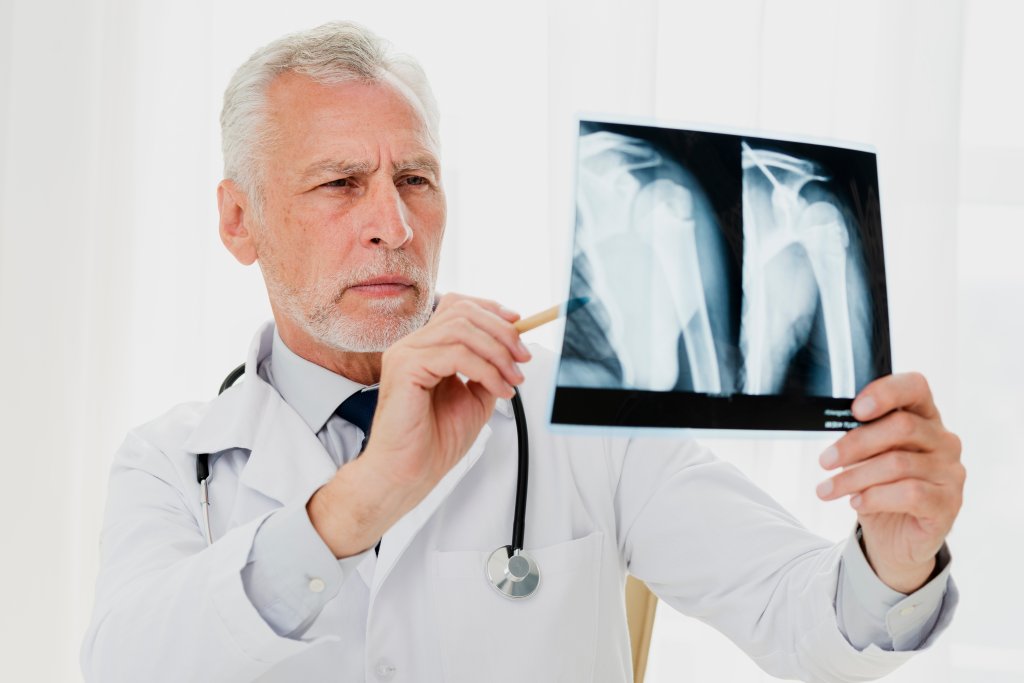 Osteopenia: conheça a condição que afeta os ossos