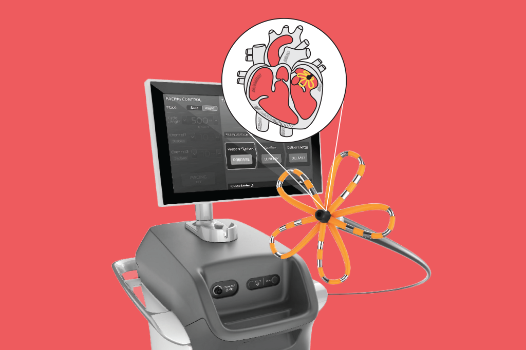 fribrilacao-atrial-tecnologia