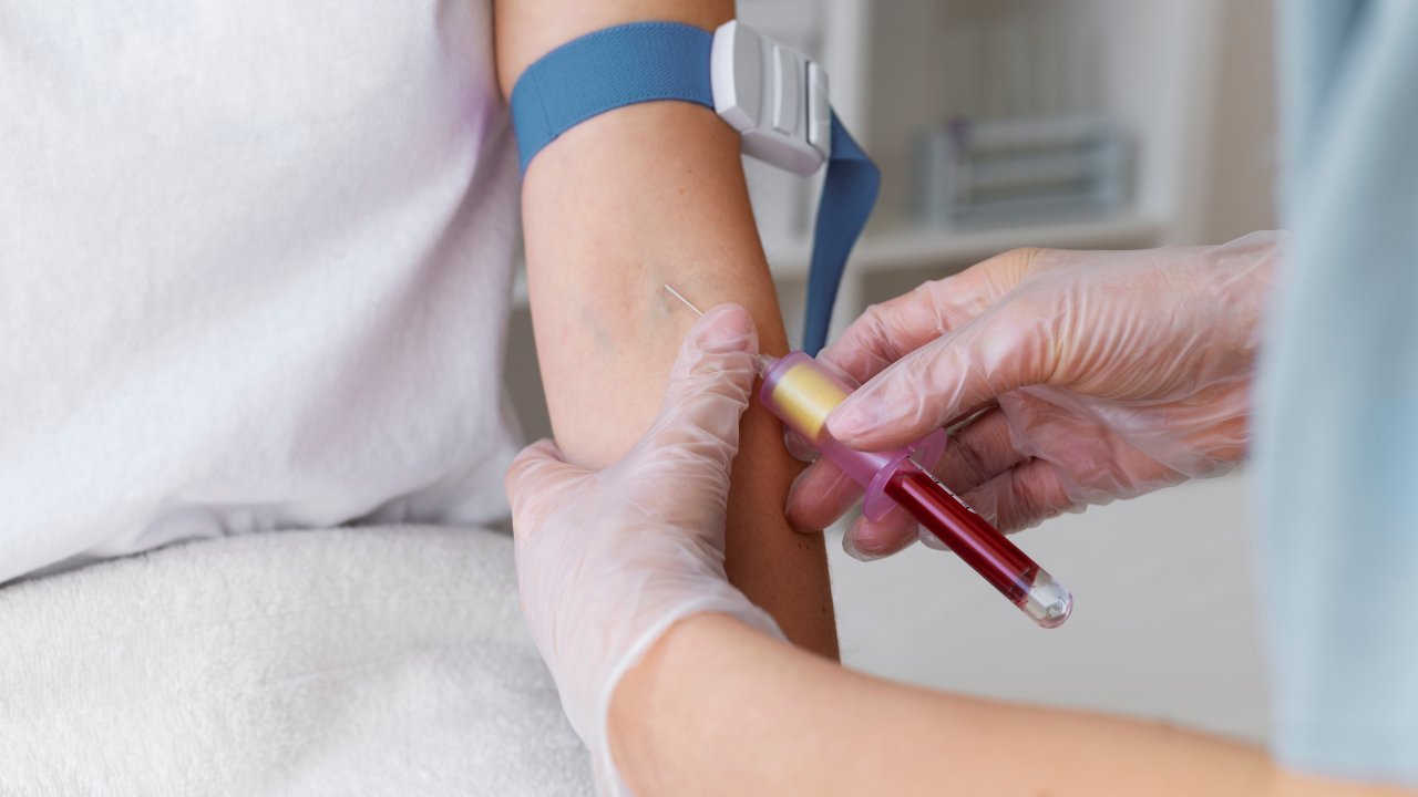 exame-sangue-ureia