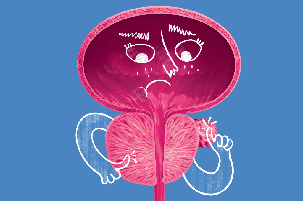 Câncer de próstata aumenta risco de doenças cardiovasculares