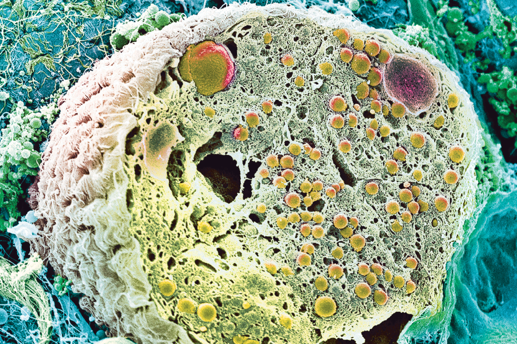 Zoom: para manter o abastecimento