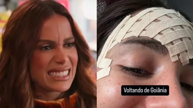 anitta-veia-testa