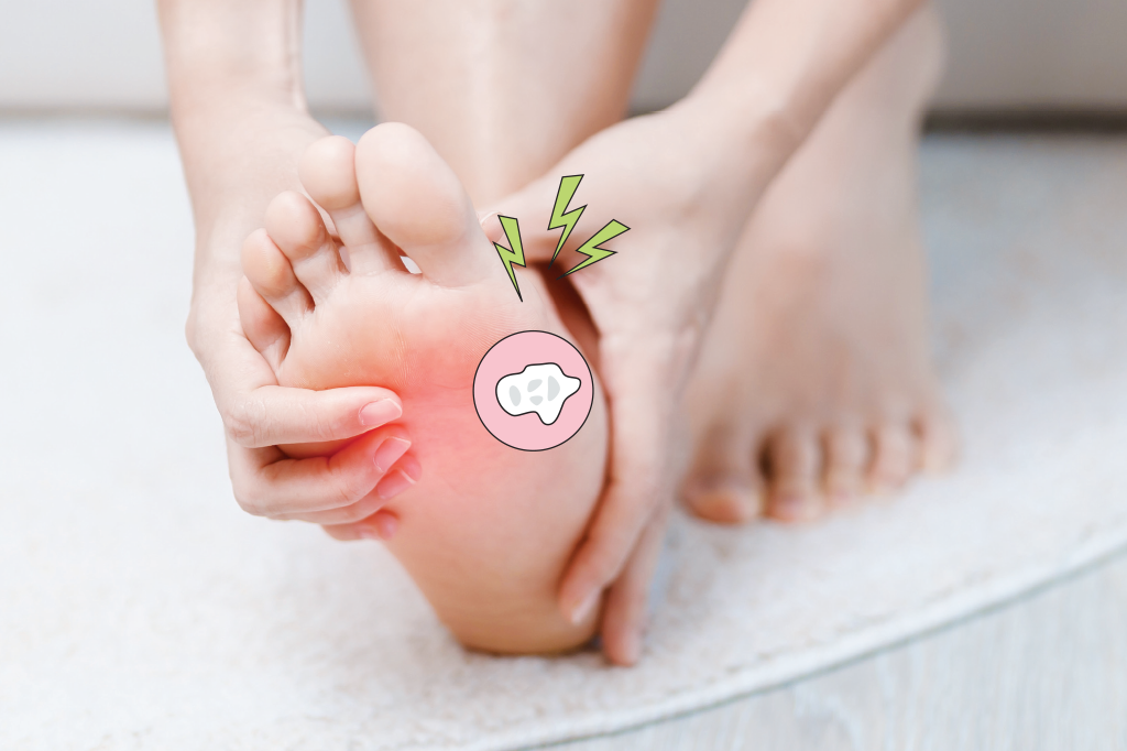 Olho de peixe: o que é e como surge esse problema?