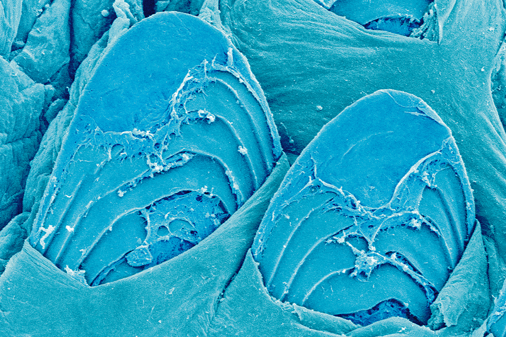 Zoom: na crista das ondas… só que não!