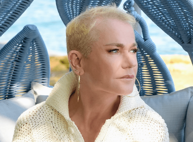 Alopecia androgenética: saiba mais sobre a condição que afeta Xuxa