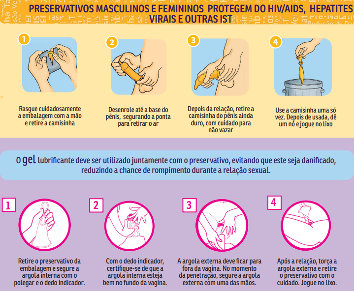 saude-medicina-sexo-prevencao-preservativo-feminino-interno-modo-de-usar saude-medicina-sexo-prevencao-preservativo-feminino-interno-modo-de-usar