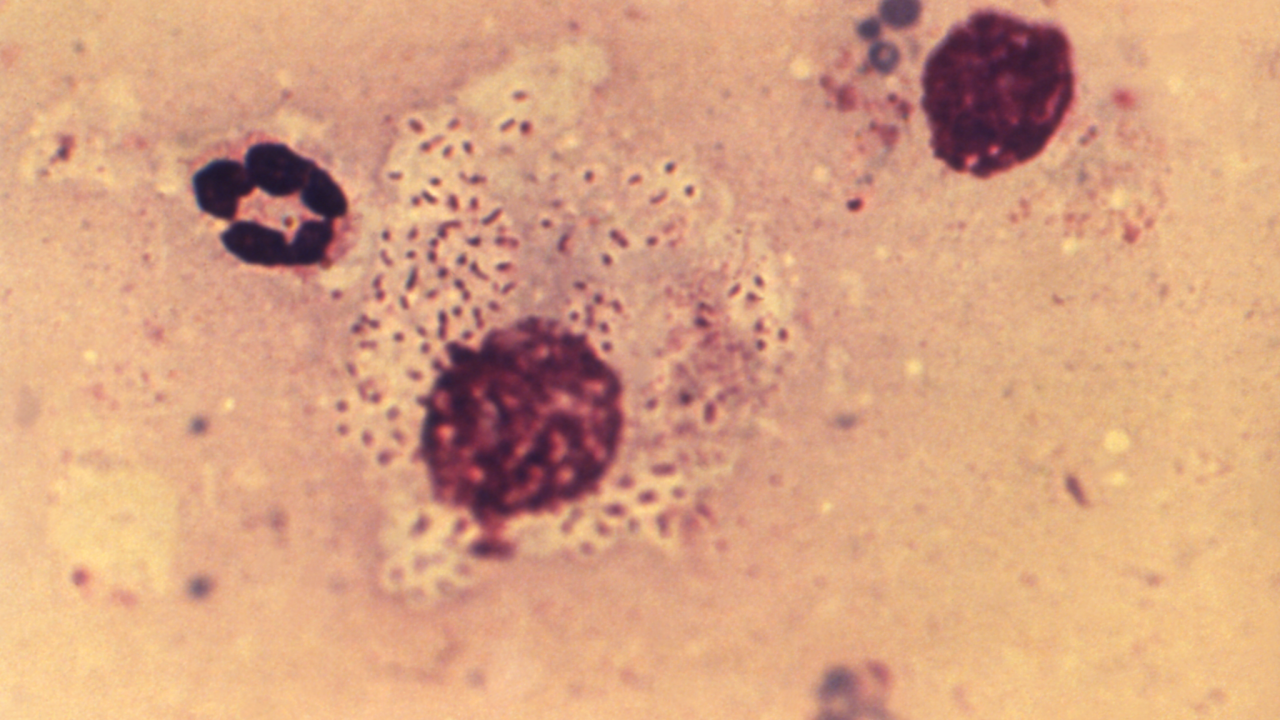 donovanose-bacteria