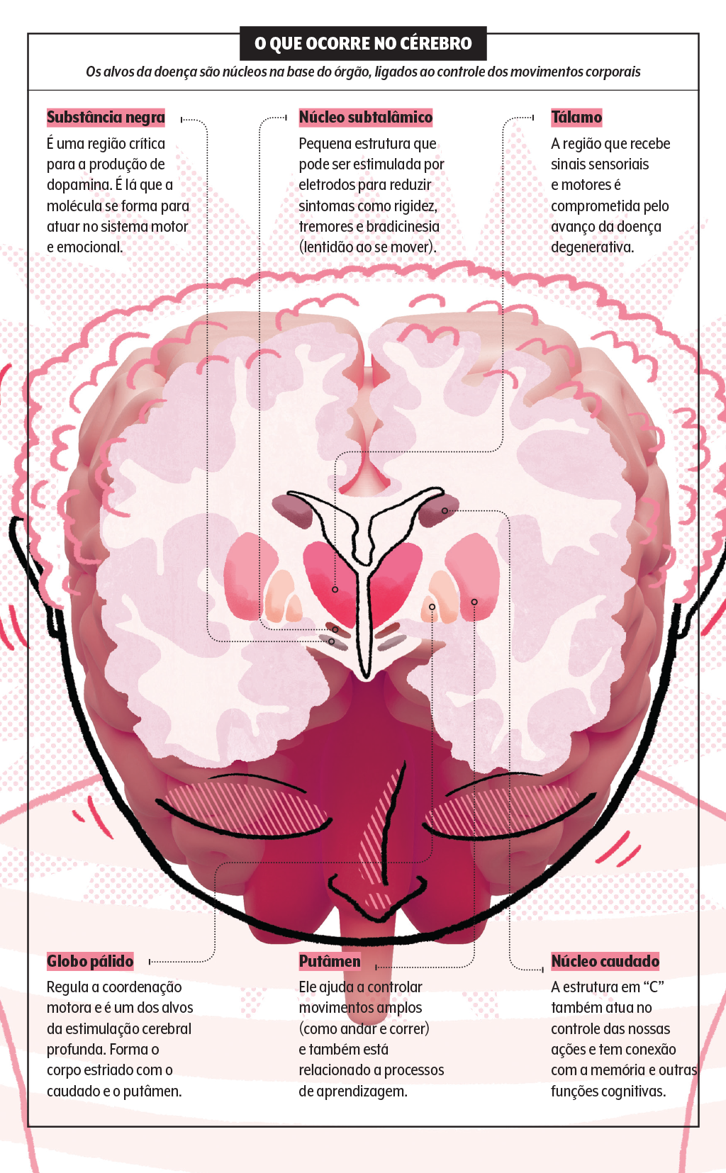 parkinson-cerebro parkinson-cerebro