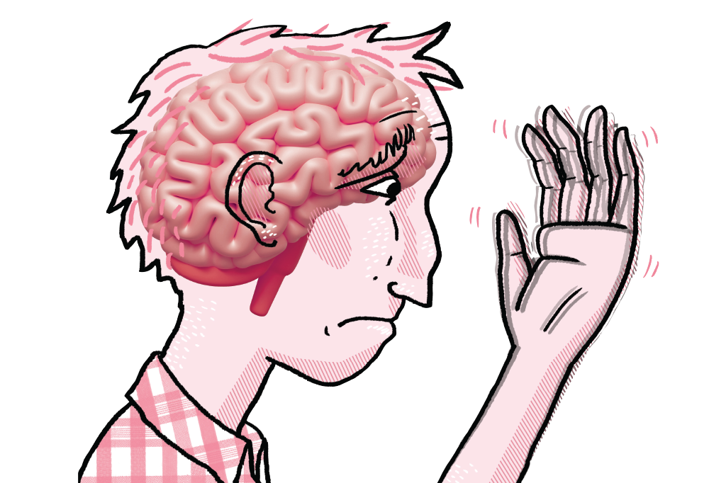 parkinson