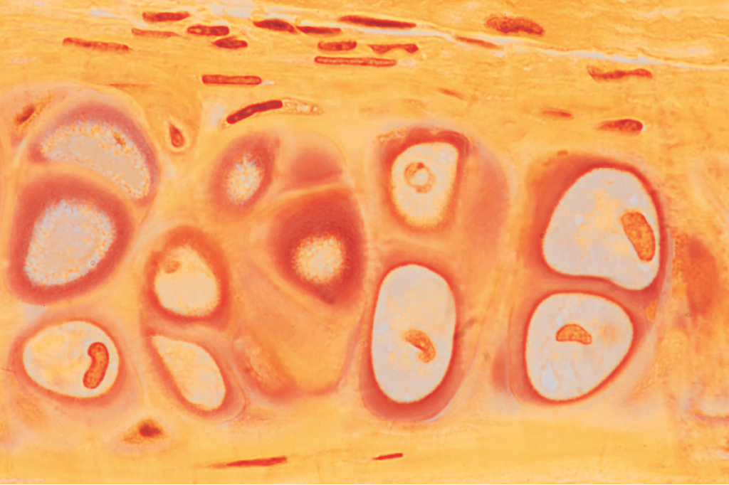 Zoom: um sopro de vida