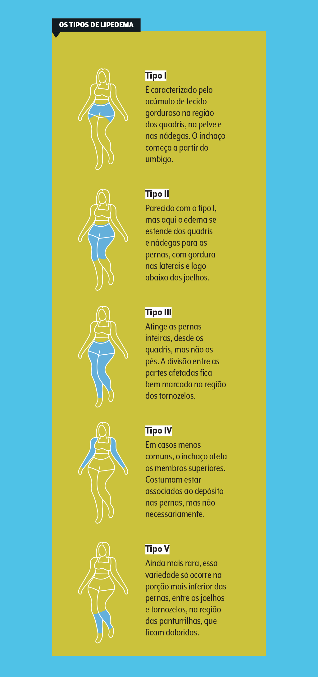 saude-medicina-lipedema-dados-2-2 saude-medicina-lipedema-dados-2-2