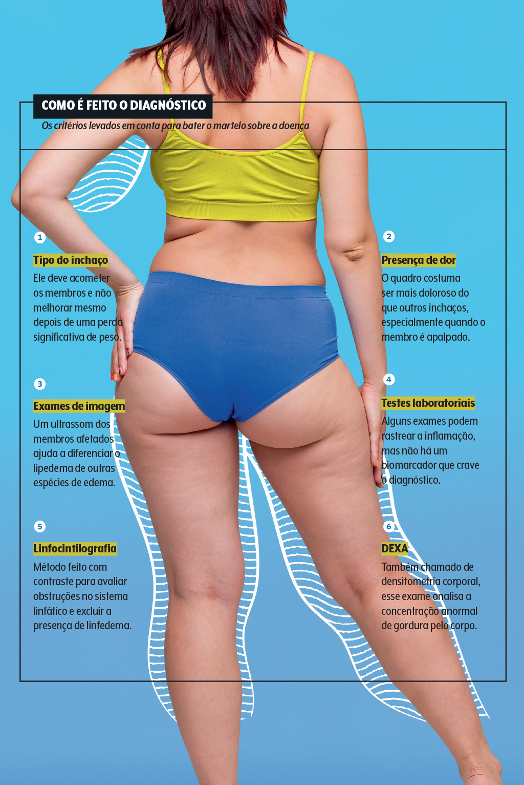 saude-medicina-lipedema-dados-2 saude-medicina-lipedema-dados-2