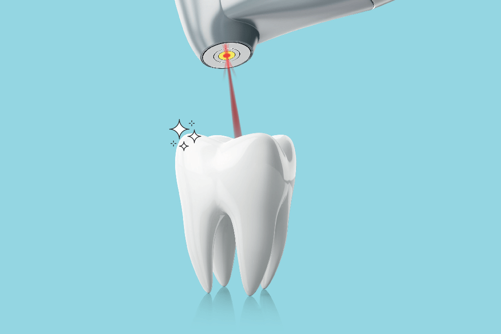 laser-limpeza-bucal