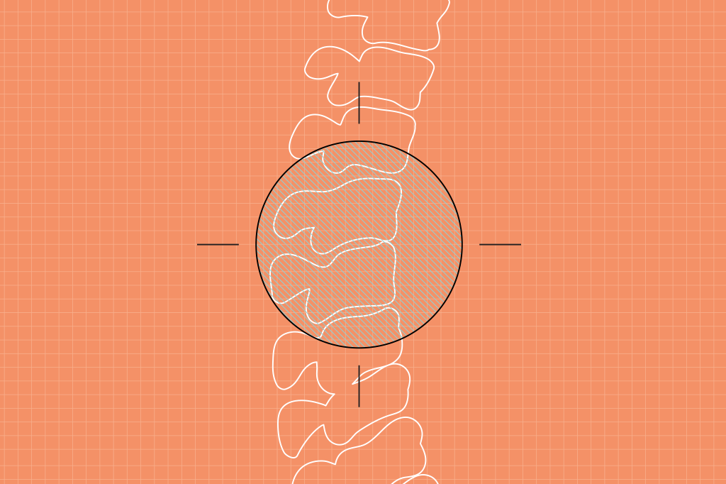 Uma rara odisseia: pesquisa revela os desafios de quem tem AME tipo III